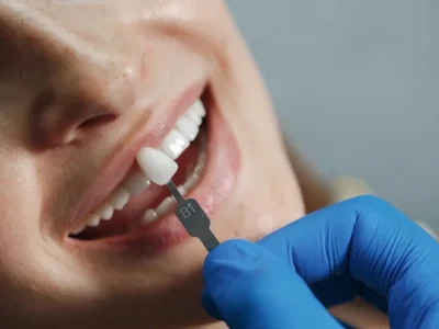 Lente de contato dental